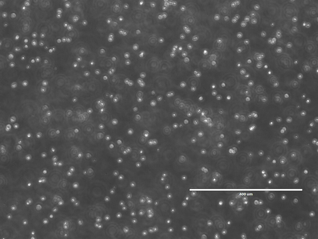 UCB CD34 cells in culture_10X.jpg